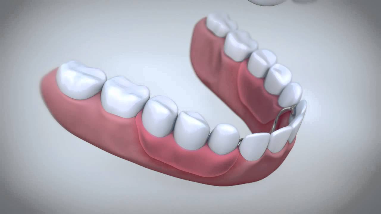 denture-sore-mouth-tiew-dental-clinic-malaysia